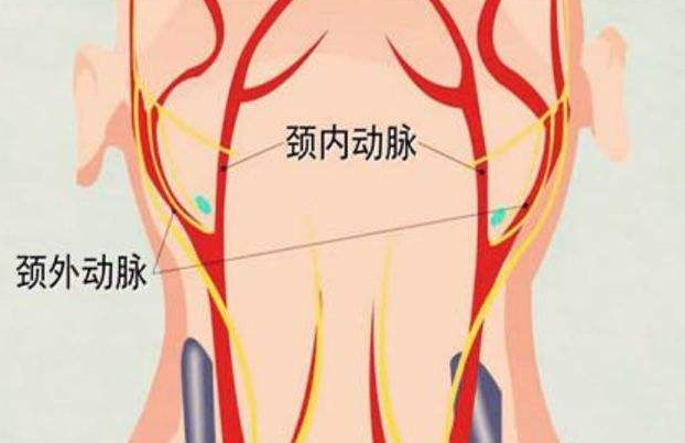 頸動脈是心腦連接生命線